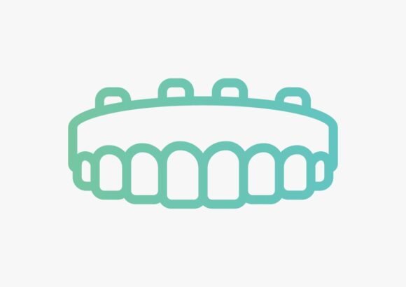 10. Hybrid Denture Hybrid Denture