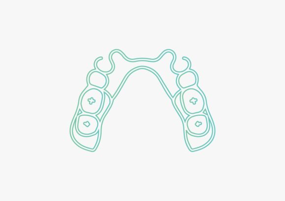 9. RPD Removable Partial Denture RPDS