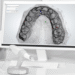 Which Dental CAD Design Services is Better for your Dental Lab?